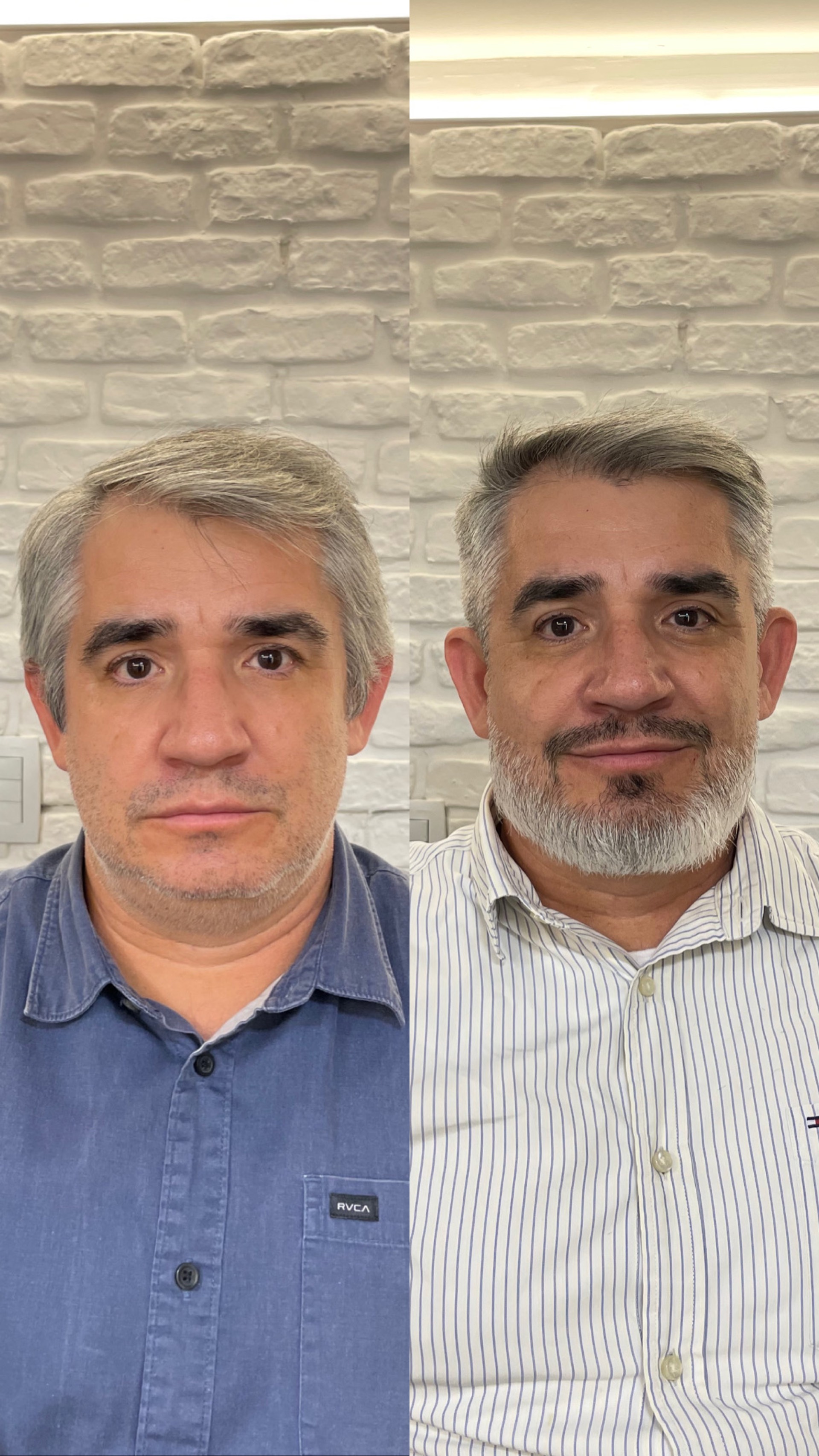Resultado visagismo